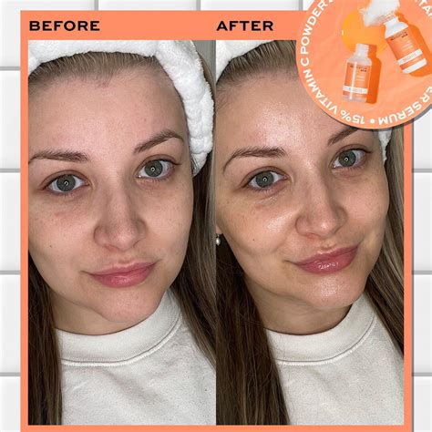 Revolution Skincare Vitamin C Powder Serum | Revolution Beauty