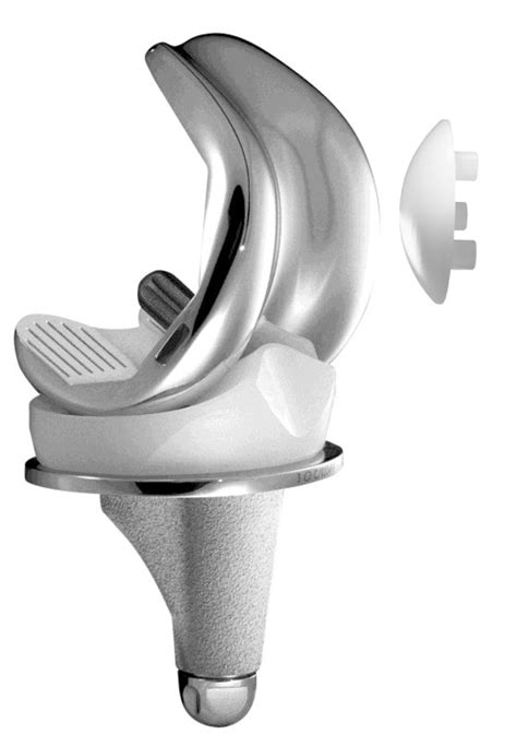 Total Knee Arthroplasty (TKA)