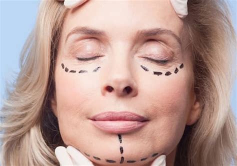 Cosmetic Procedure Finance