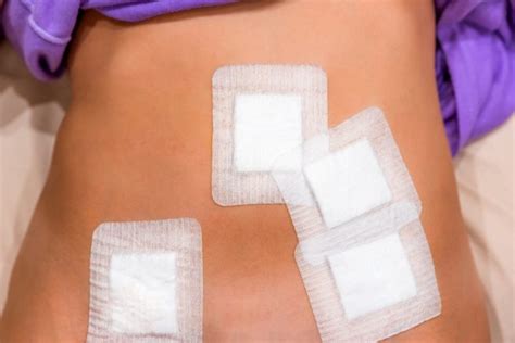 How to Care for Your Gastric Sleeve Incisions - Tuck and Sleeve