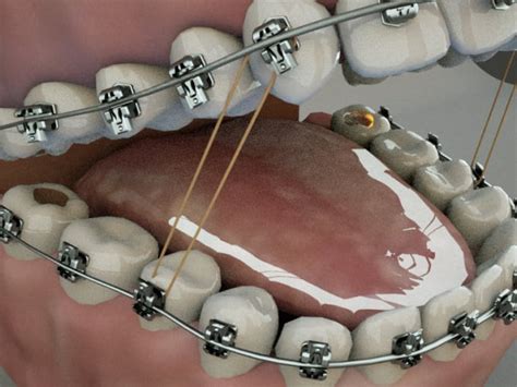 Create 3d dental and medical animation by Addax_graphics | Fiverr