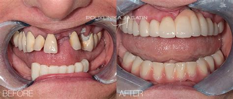 Dental implantology