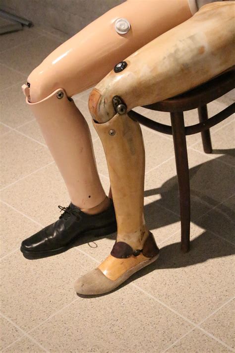 The History of Artificial Limbs – Typelish