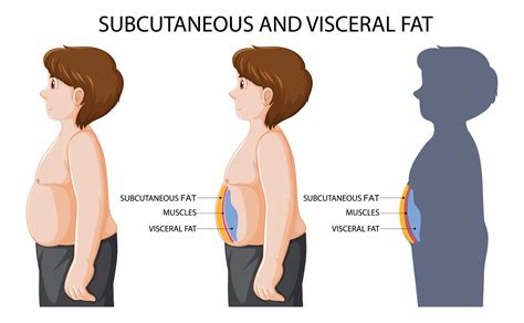 Subcutaneous Vs Visceral Fat Fat The Difference Between Visceral Fat