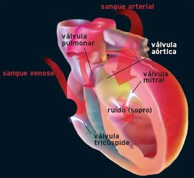 O Que É Um Sopro No Coração - Enfermagem em cardiologia: Sopro no coração