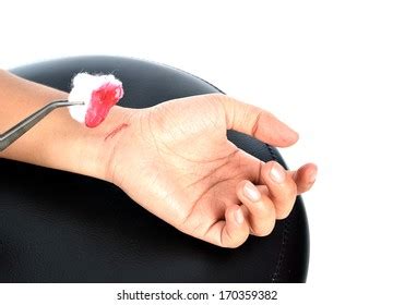 2,606 Wound Cleaning Images, Stock Photos, 3D objects, & Vectors ...