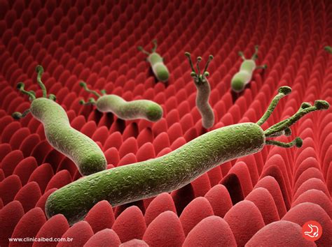 Helicobacter Pylori É Contagioso - Helicobacter Pylori : Sintomas, Diagnóstico E Tratamento – KTIR
