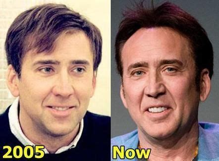 Nicolas Cage Plastic surgery Fact or Rumor | Plastic surgery, Nicolas ...
