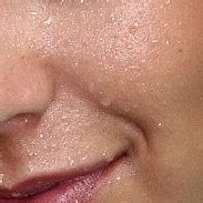 Perspiration | Wiki | Everipedia