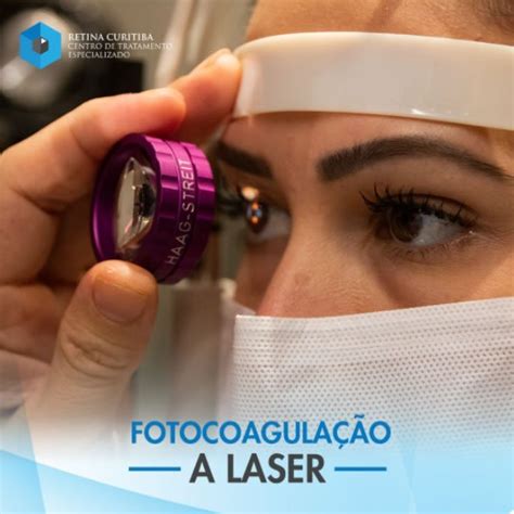 Fotocoagulação A Laser Dói - Fotocoagulacao Focal A Laser LASER Na Retina Dr Roger Miranda