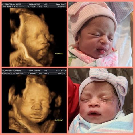 ultrasound testimonials   ultrasound  ft myers fl