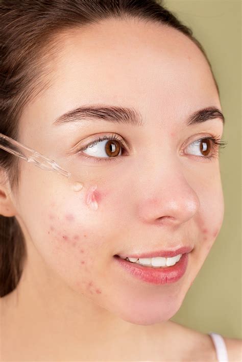 Is Keloid Scar Tissue A Complication Of Chronic Inflammation? - Treat