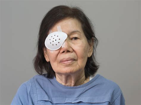 phacoemulsification simplified patient guide