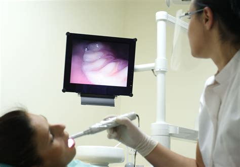 The Intraoral Camera - Unique Dental of Worcester
