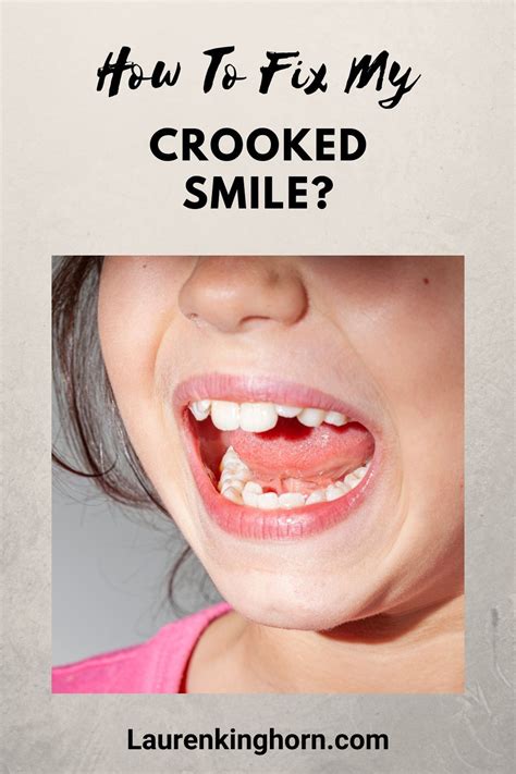 how to fix crooked smile