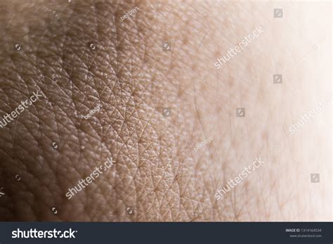 scaling skin stock photo  shutterstock