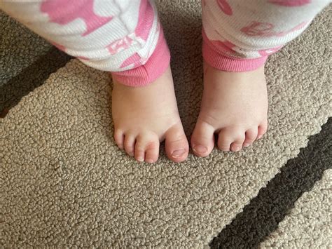 Double toes! : r/mildyinteresting