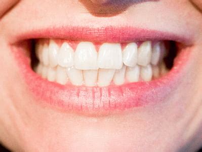 photo mouth tooth macromodelo dentist hippopx