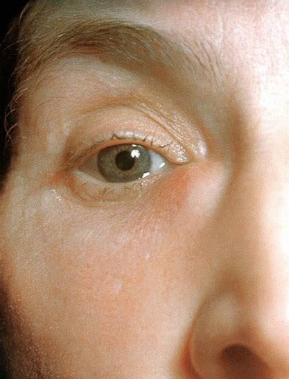 definition rcemlearning india