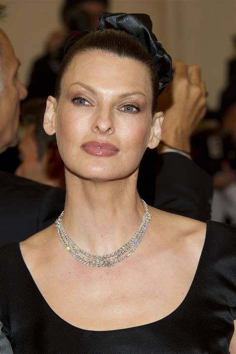 linda evangelista  suing  coolsculpting procedure los