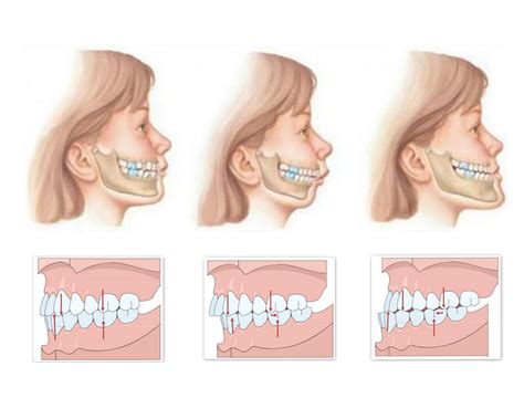 Como a Osteopatia aborda a Má Oclusão | Osteopatia Vanessa Faria Lopes