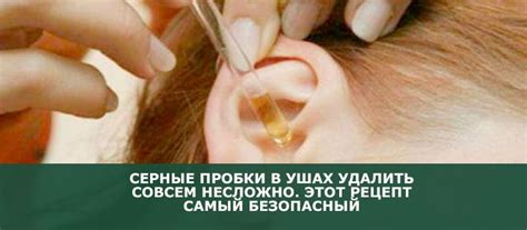 Серные пробки в ушах удалить совсем несложно. Этот рецепт самый ...