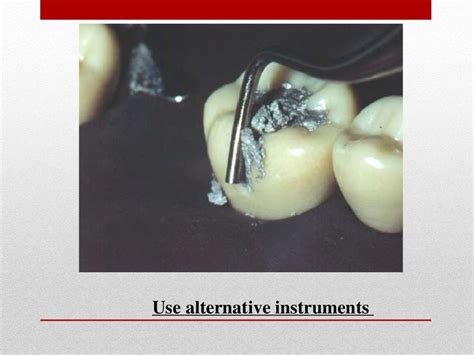 procedure for amalgam restoration
