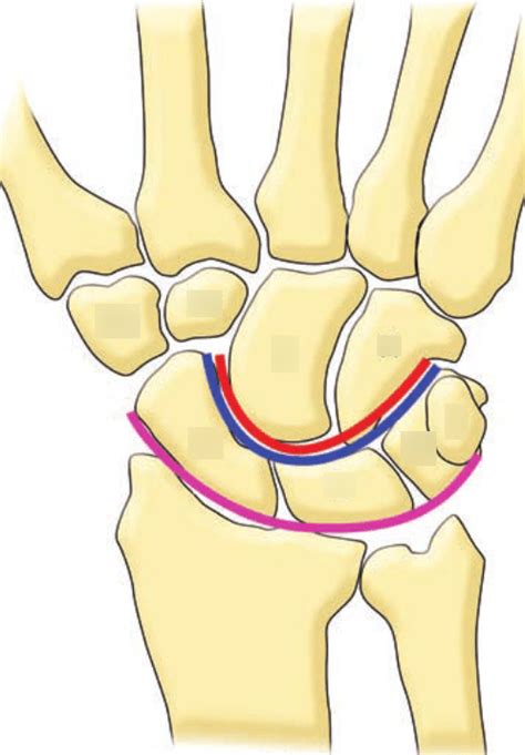 diagram  label  bones   wrist carpal bones quizlet