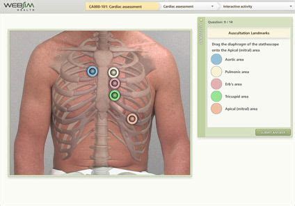 Heart Auscultation Locations