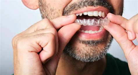 How to Heal Your Gums When Wearing Aligners – Healthy Smile Pharmacy