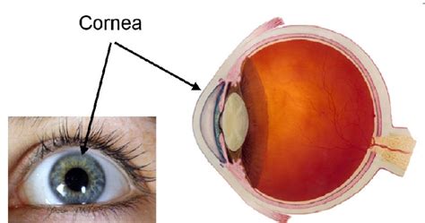 Pharma show : All Conditions of the cornea and their Causes ...