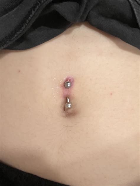 is my navel piercing rejecting : r/piercing