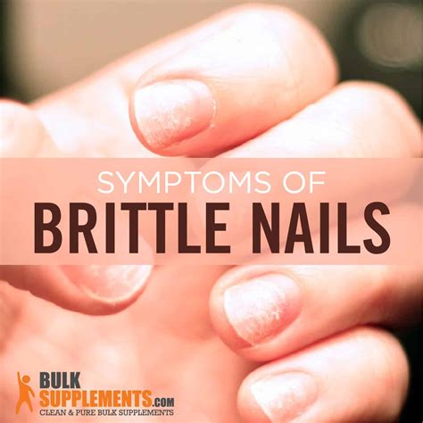 Iron Deficiency Anemia Nails Vs Normal Nails at Wendell Espinoza blog