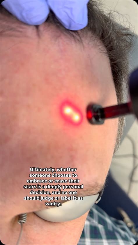 Katie Sigmond's Resilience: Overcoming the Scars of the Leak - cte21cs