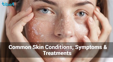 demystifying common skin diseases symptoms treatments  management