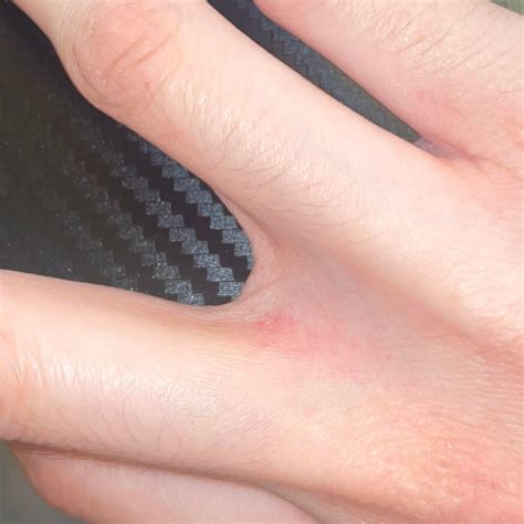 finger itchy meaning 1