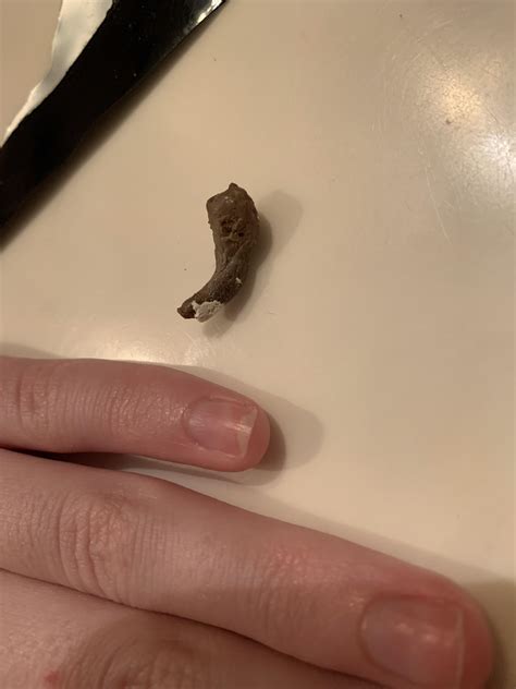 normal gecko poop? he ate some watermelon pangea and dried mealworms