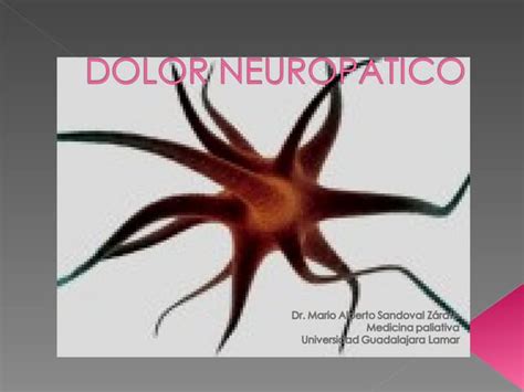 4.otras causas de dolor neuropatico