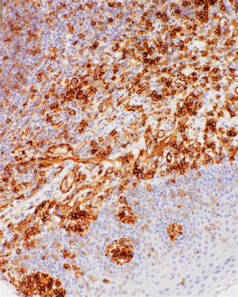geneab cd attogene