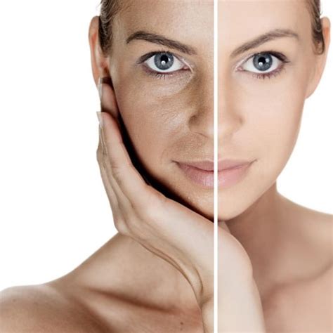 Heccus Antes E Depois - Heccus: O que é? Preço, vantagens e resultados antes e depois!