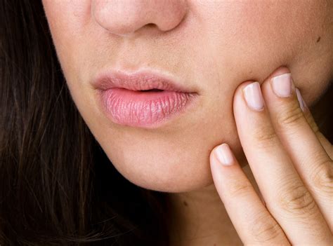 mouth ulcers  swollen lips infoupdateorg
