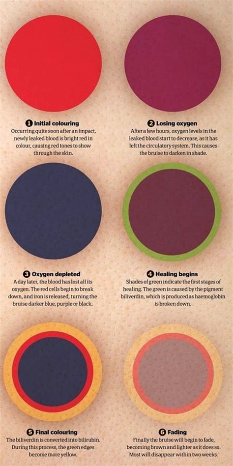 chart showing stages   bruise   color  rcourtingwonder