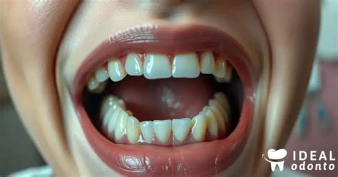 Quais São Os Nomes Dos Dentes - Descubra os Nomes dos Dentes e Suas Funções - Planos Odontológicos ...