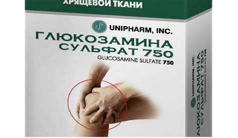 Глюкозамин сульфат: инструкция по применению, аналоги и отзывы :: SYL.ru