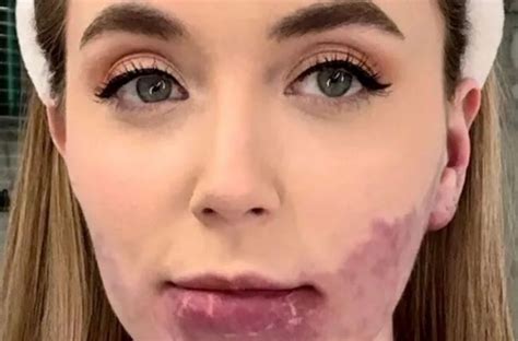 "She Had a Large Birthmark On Her Face": What Does The Girl Look Like ...