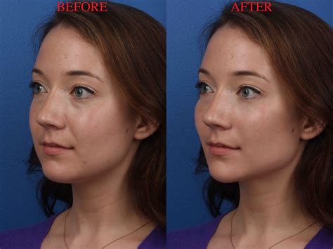 Why how much can a plastic surgeon make is surprisingly increasing 14