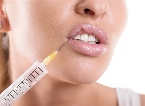 150+ Botox Injection Human Lips Injecting Red Stock Photos, Pictures & Royalty-Free Images - iStock