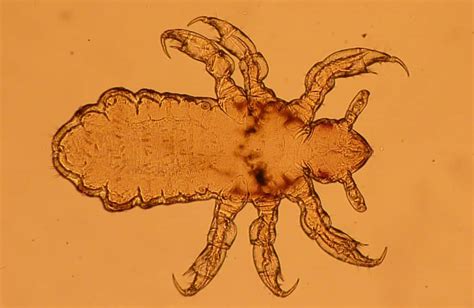 lice green pest services pest control exterminator
