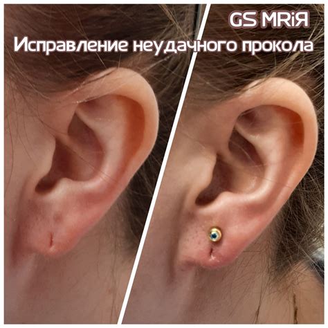 GS MRiЯ - Исправление неудачного прокола после другого мастера ...