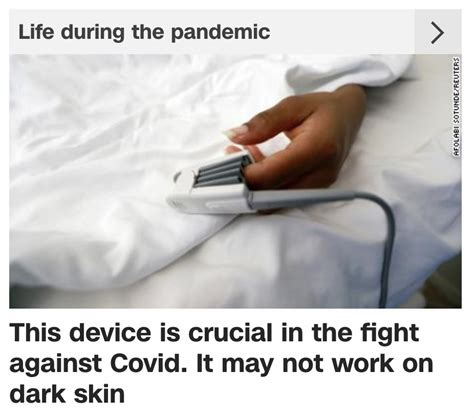 Pulse oximeters may not work well with dark skin, Black History Month Covid-19 type of news ...